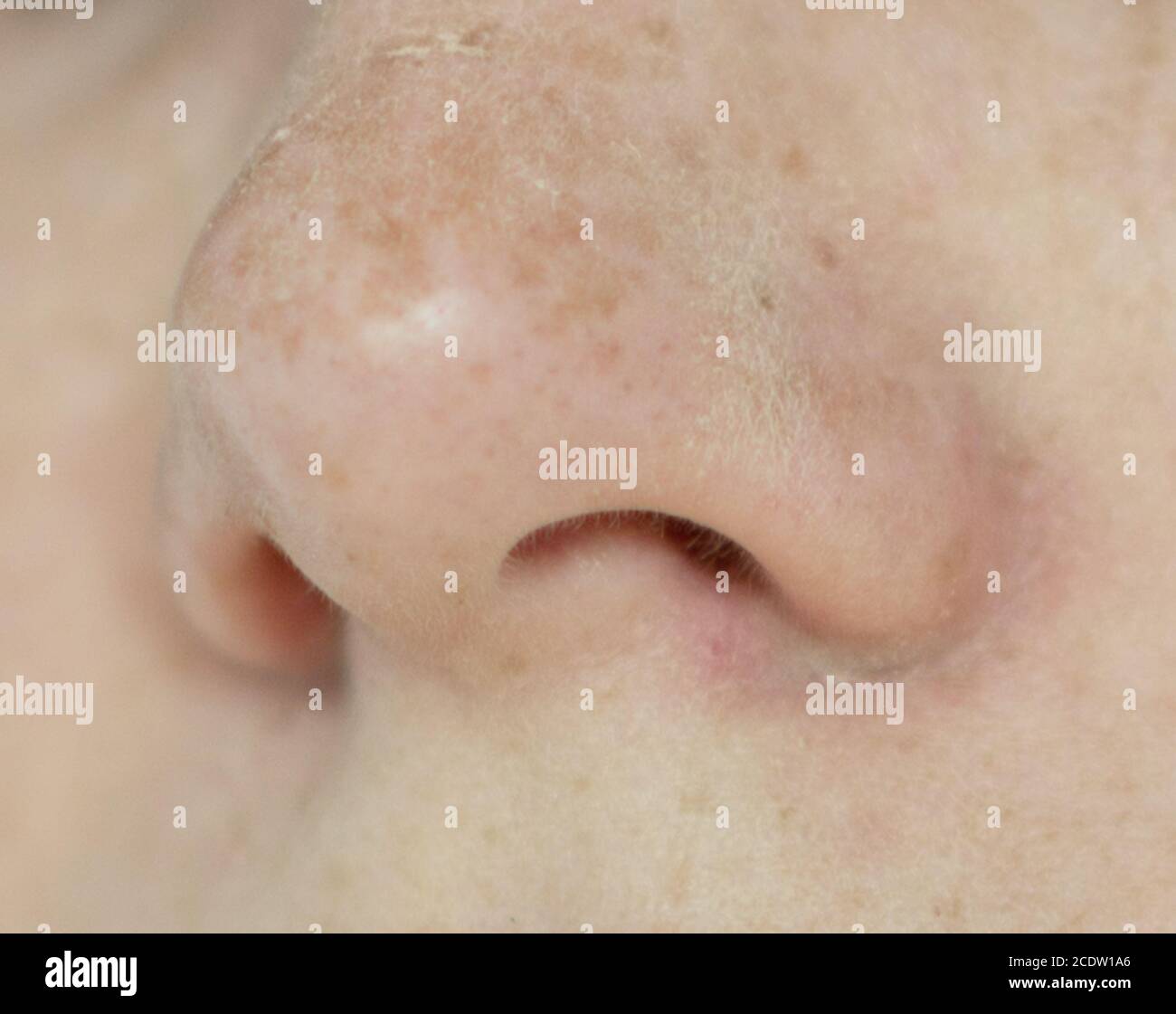Nose holes hires stock photography and images Alamy