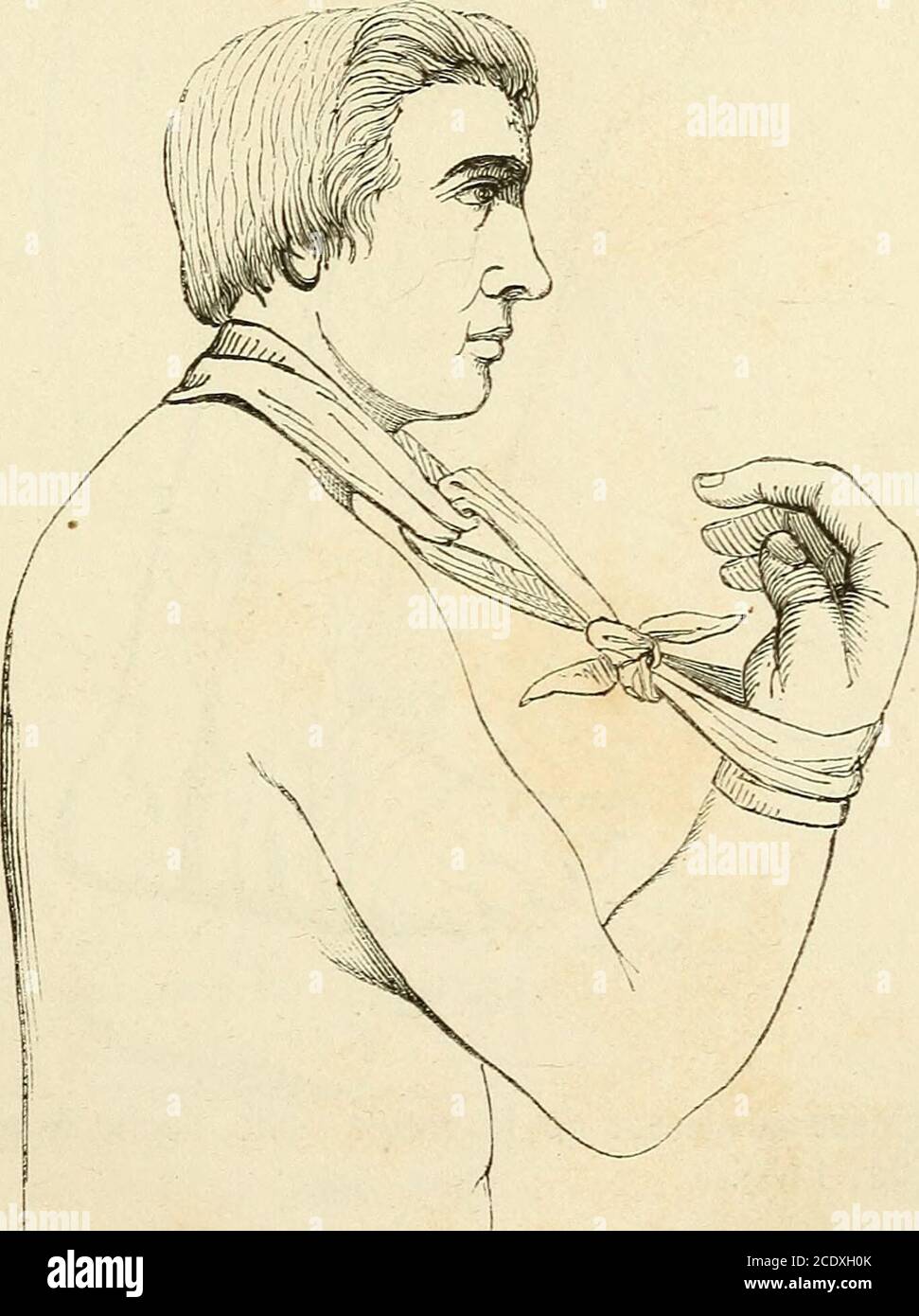 Manuel de petite chirurgie . Fig. 11 des topiques dans Faisselle, est  appliqué de la manière suivante.La partie moyenne de la cravate est placée  dans laisselle, du côté CRAVATES. 181 malade;