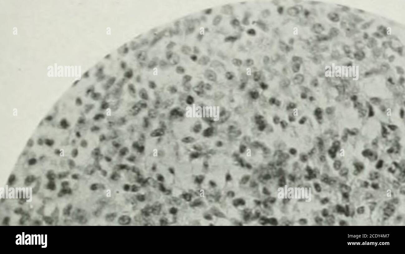 Hyperchromatic cell nuclei hires stock photography and images Alamy