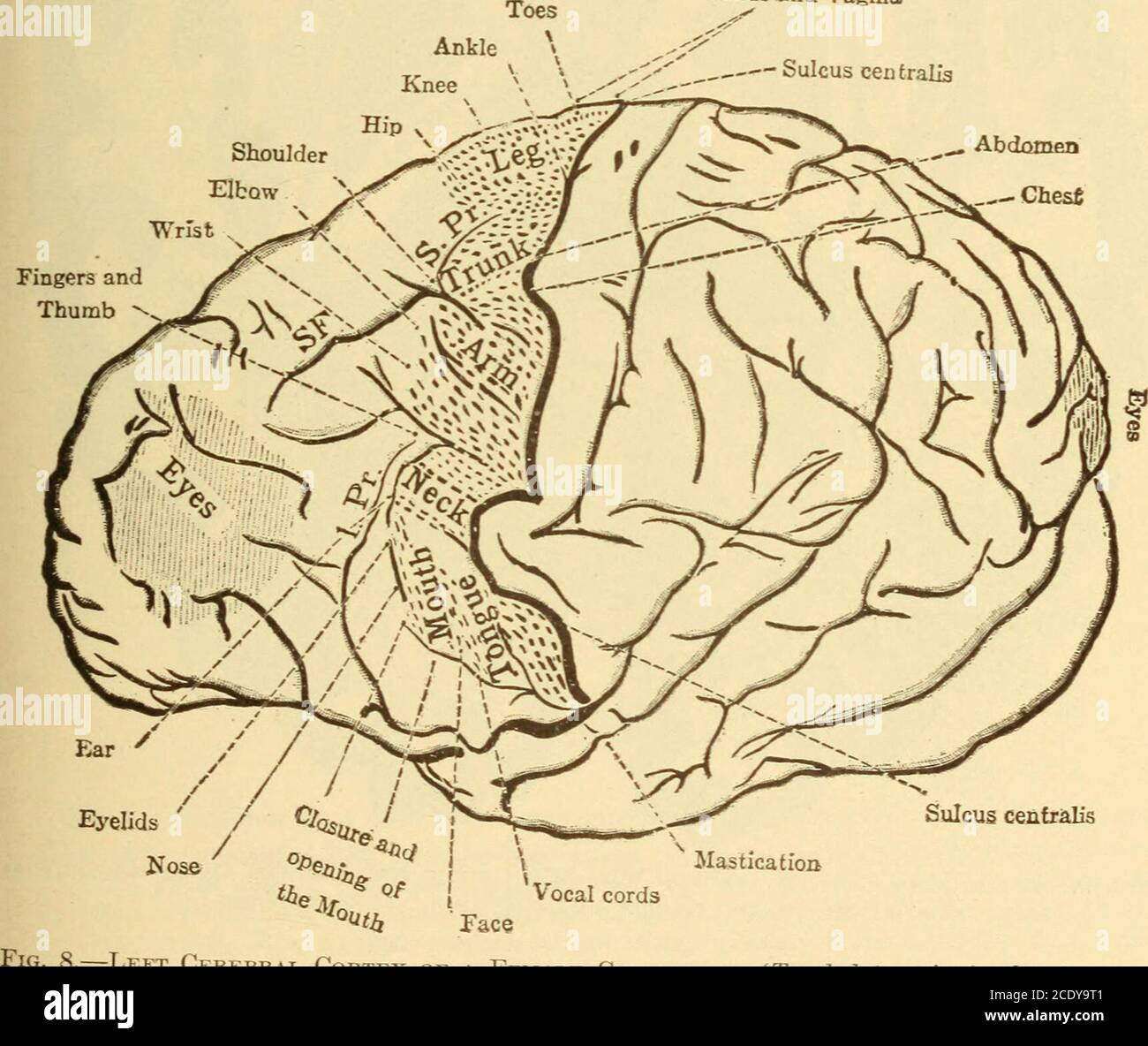 Diseases Of The Nervous System Its Various Modi Fications Y E Cannot Here Discuss The Enormous Extension Of The Localizationof Speech Disturbances In The Teachings Of The Last Few Years In