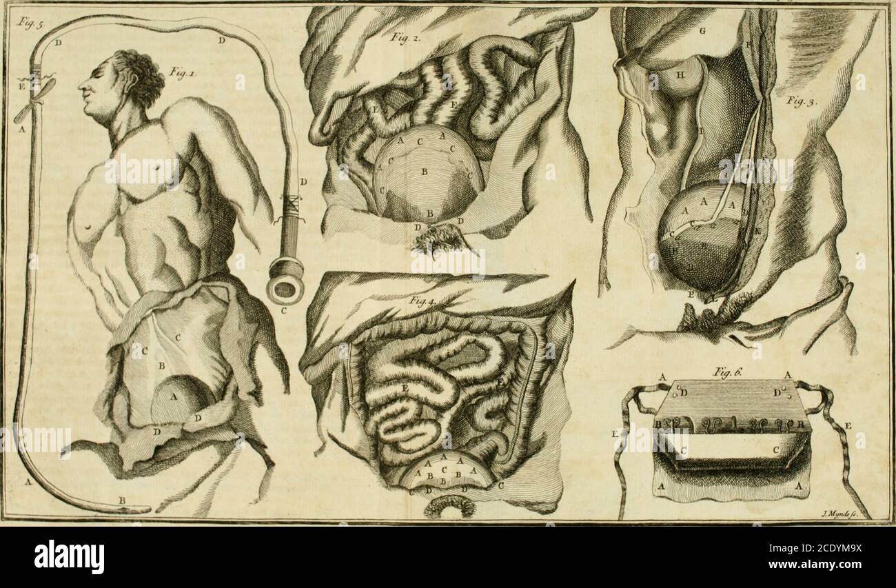 . A general system of surgery in three parts : Containing the doctrine ...
