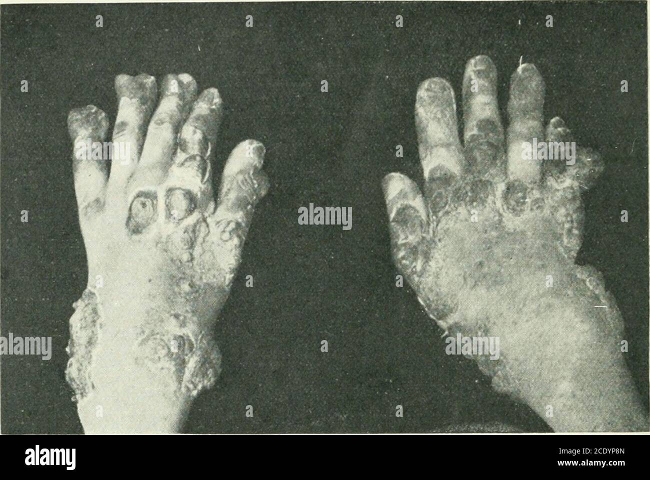 The British journal of dermatology . ith accuracy after a very 