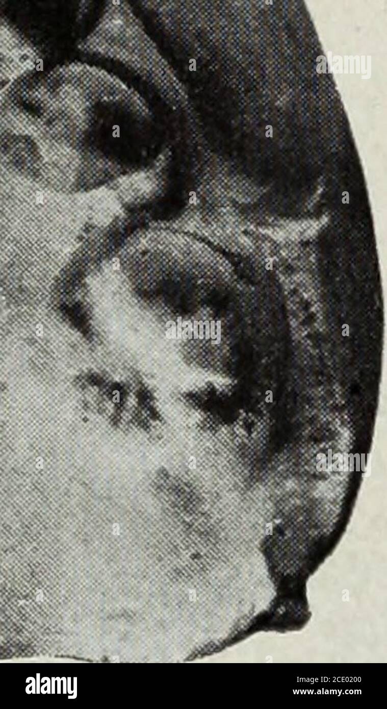 . The Dental cosmos . Model of lower teeth and jaw, before opera-tion ...