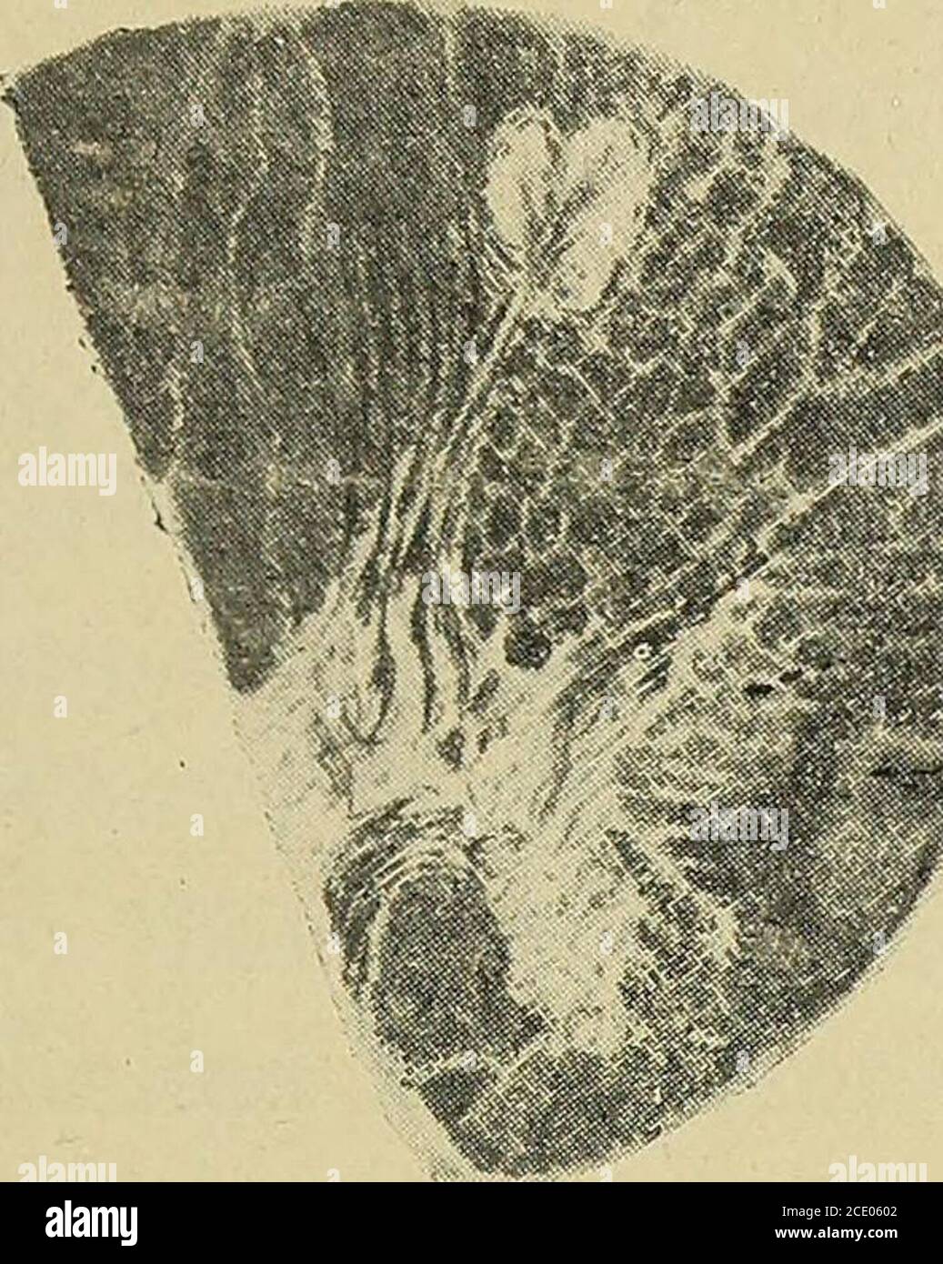 Rarification . The journal of mental pathology . he sectionis almost circular (fig ...