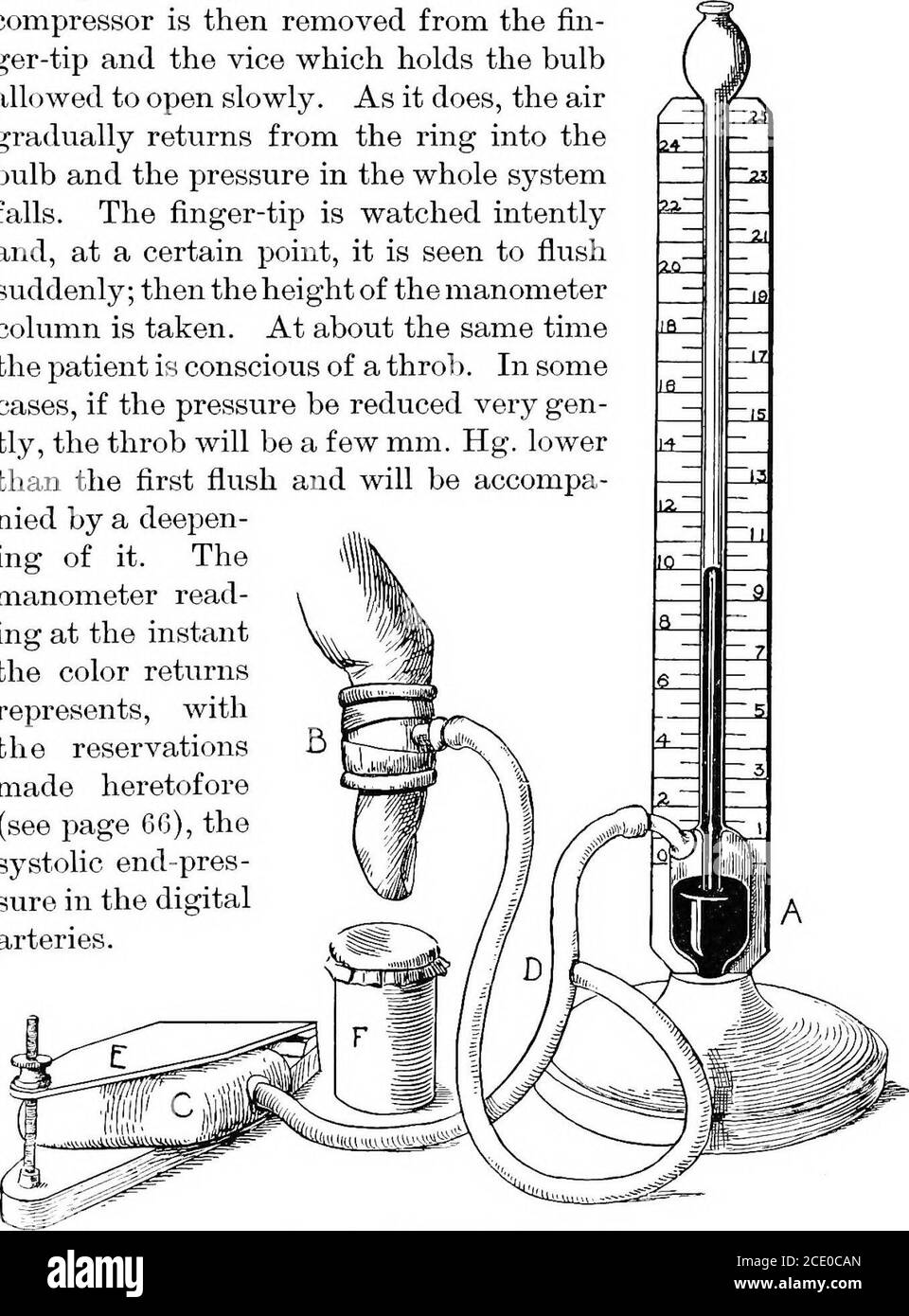 Suggest the suitable transducers for measurement of respiration rate blood  pressure cardiac output Discuss any one application with neat sketch in  detail