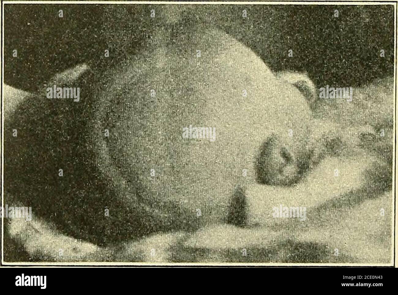 Comatose Brain High Resolution Stock Photography And Images Alamy Comatose Brain High Resolution Stock Photography And Images Alamy