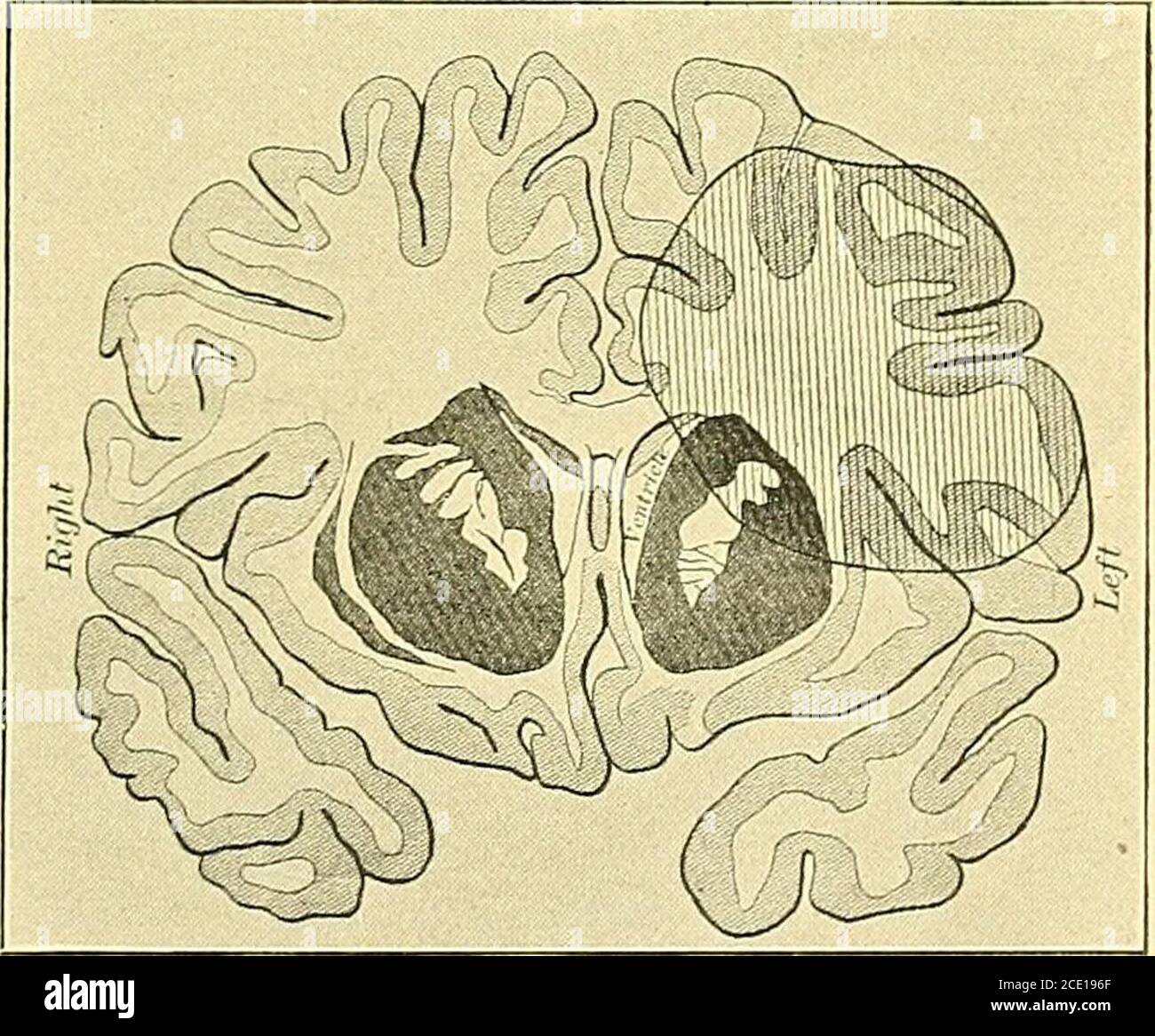 Parietal Ridge Infant Parietal ridge hi-res stock photography and images - Alamy