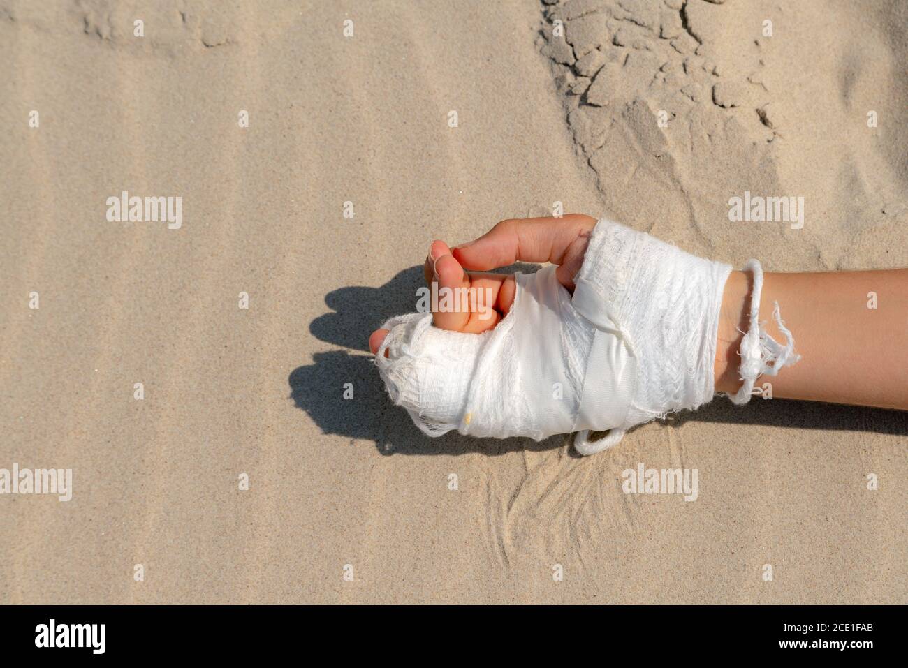 Broken hand in white cast on blue background with copy space for text. Finger cast trauma Stock