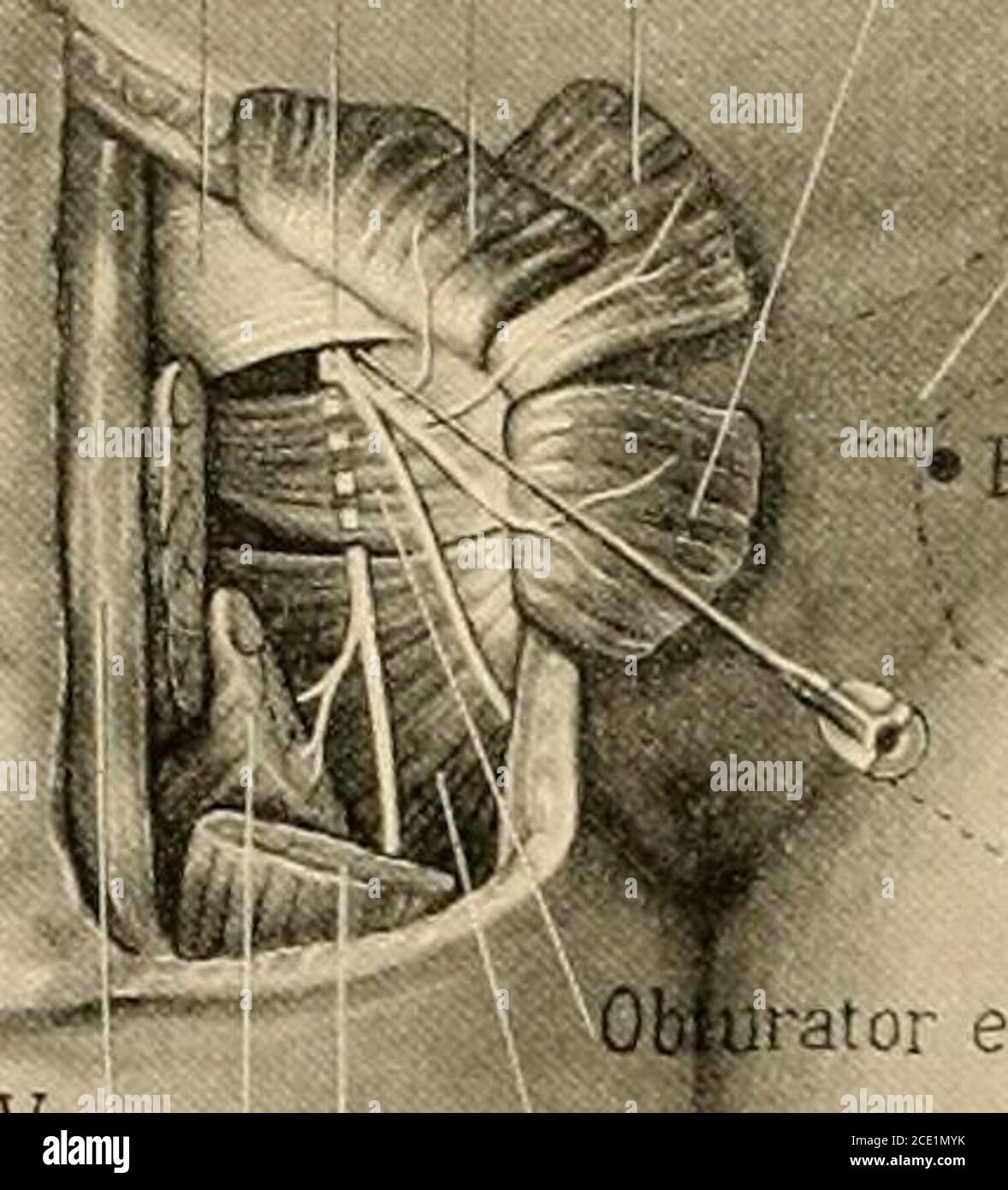 Obturator canal hi-res stock photography and images - Alamy