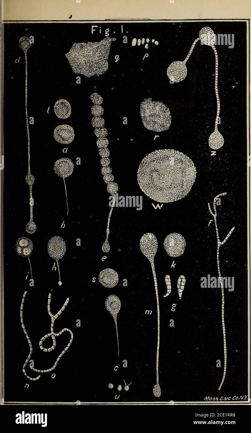 Gaillard S Medical Journal Tents V X Y Z Nnear Z Contents More Highly Magnified Plate 7 Fig 8 Bodies Found In Urineof Scarlet Fever A B C Sporangia Of Mu Cor Malignans D Parent Epithelial Cellsfrom Bladder E