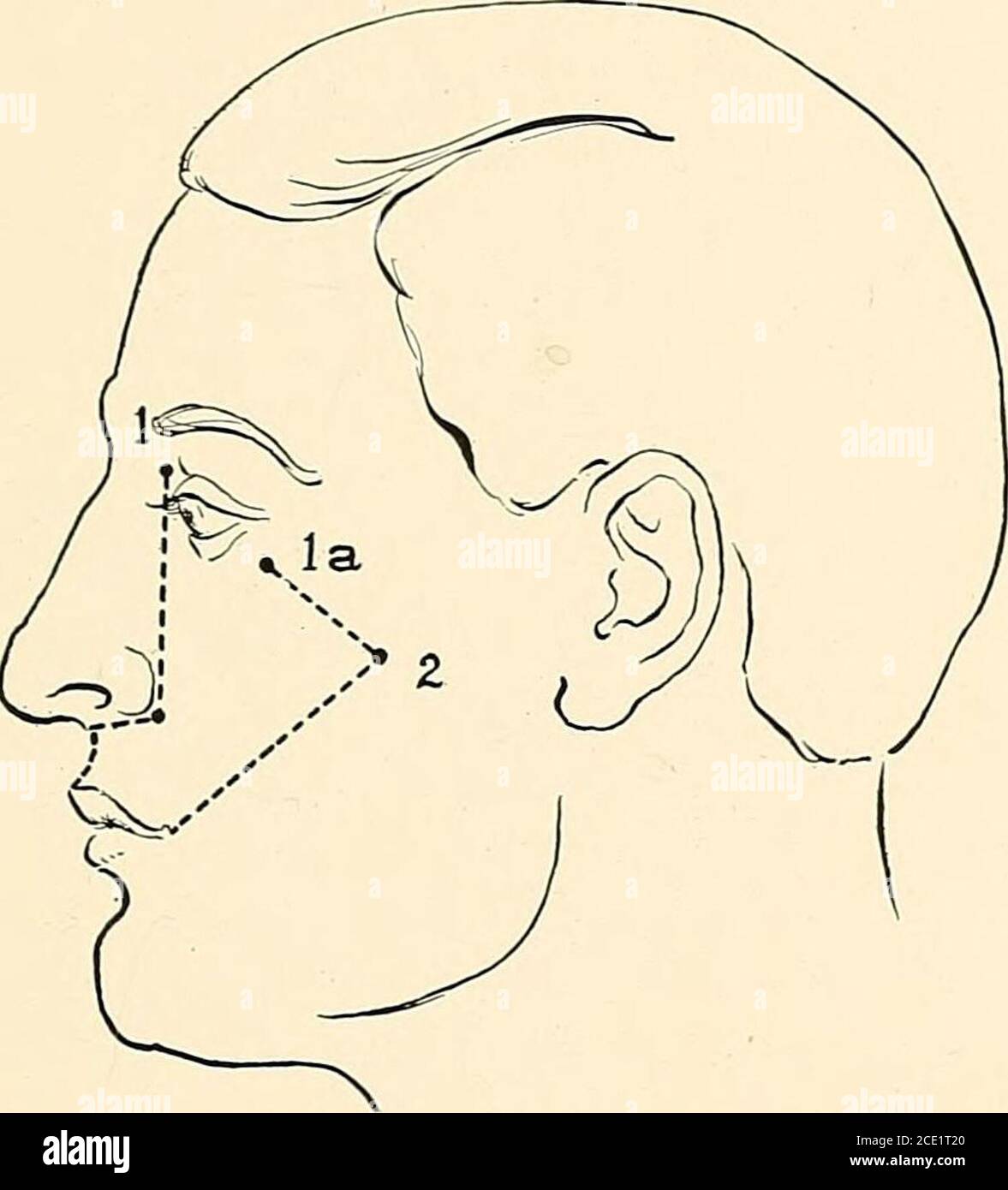 . Regional anesthesia : its technic and clinical application . if the ...
