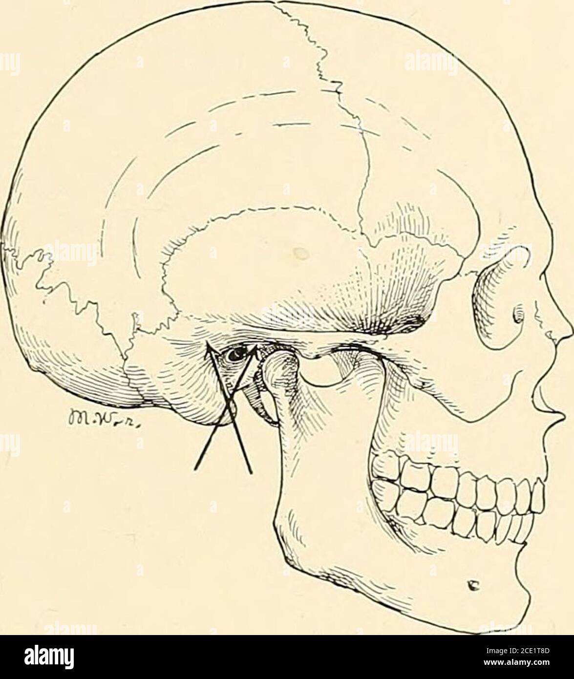 . Regional anesthesia its technic and clinical application . deep in