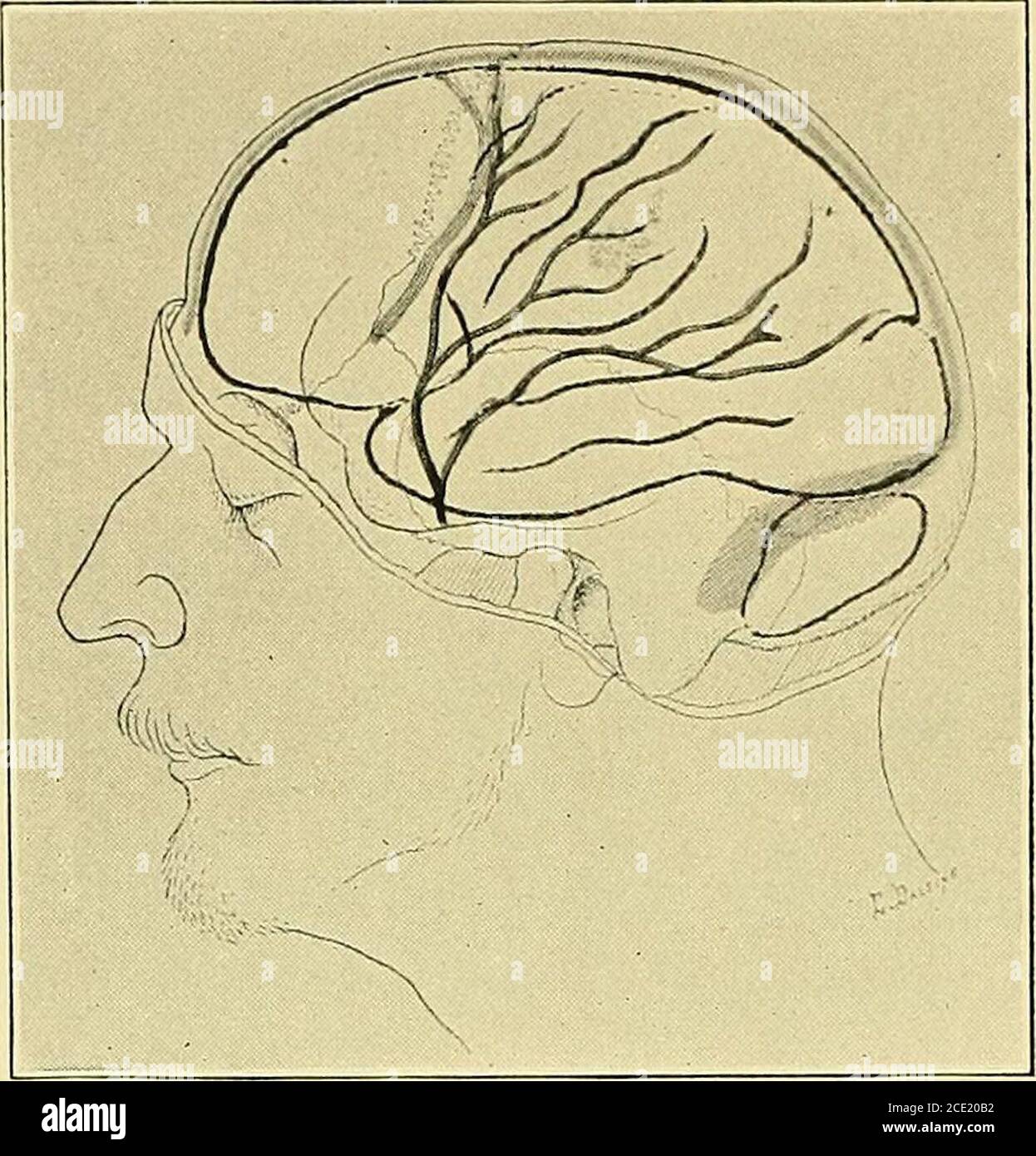Some Points In The Surgery Of The Brain And Its Membranes The Field Of Vision Was First Lost Towards Thelast She Also Lost The Faculty Of Direction So That Shecould Some Points In The Surgery Of The Brain And Its Membranes The Field Of Vision Was First Lost Towards Thelast She Also Lost The Faculty Of Direction So That Shecould