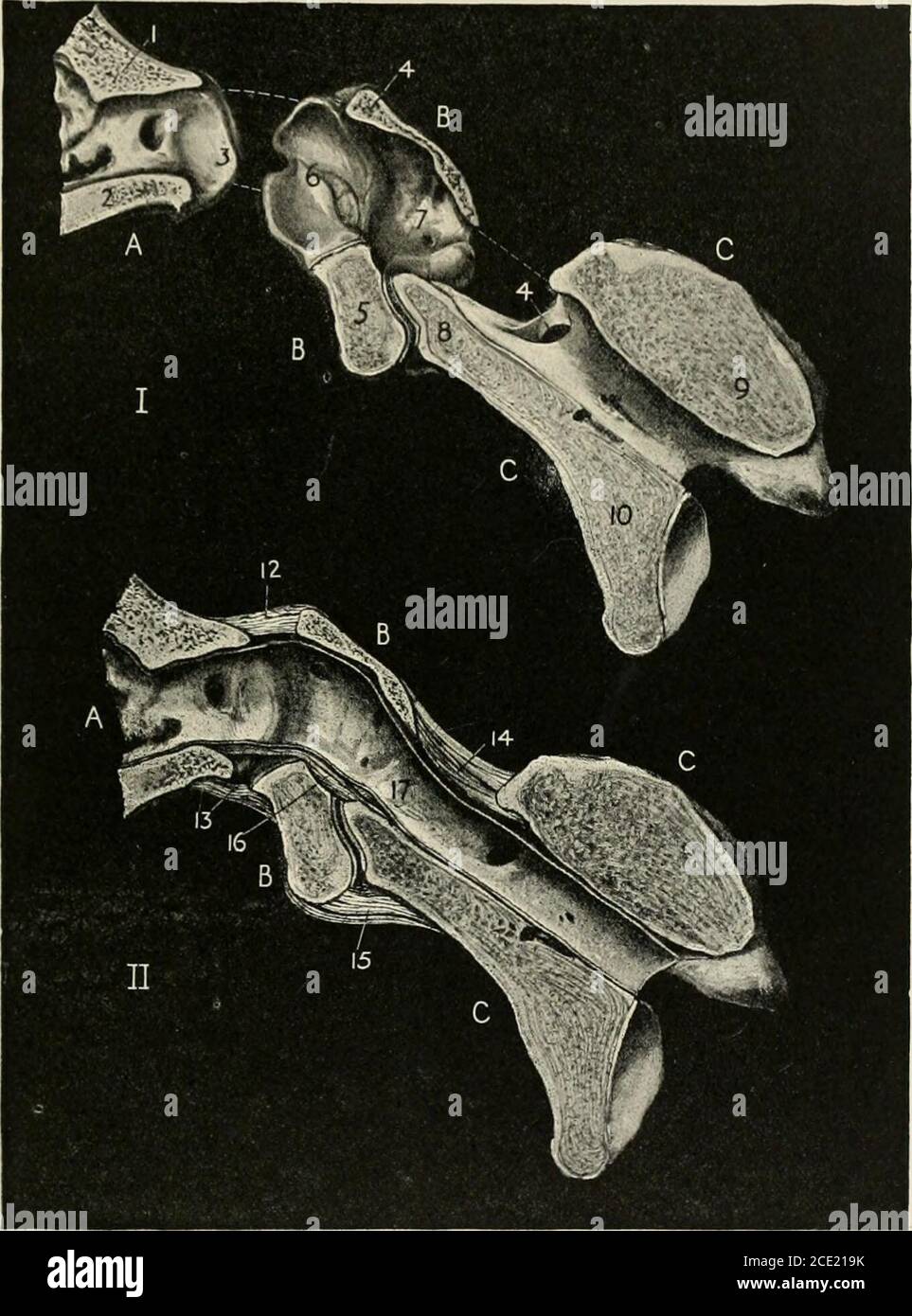 A manual of anatomy . .—The right temporo-mandib-ular articulation seen  from the outerside. {Sobotla anil McMurrich.) Fig. 87.—The right temporo- mandibu-lar articulation seen from the inner side.{Sobotta and McMurrich.)  lates with the demifacet of the two