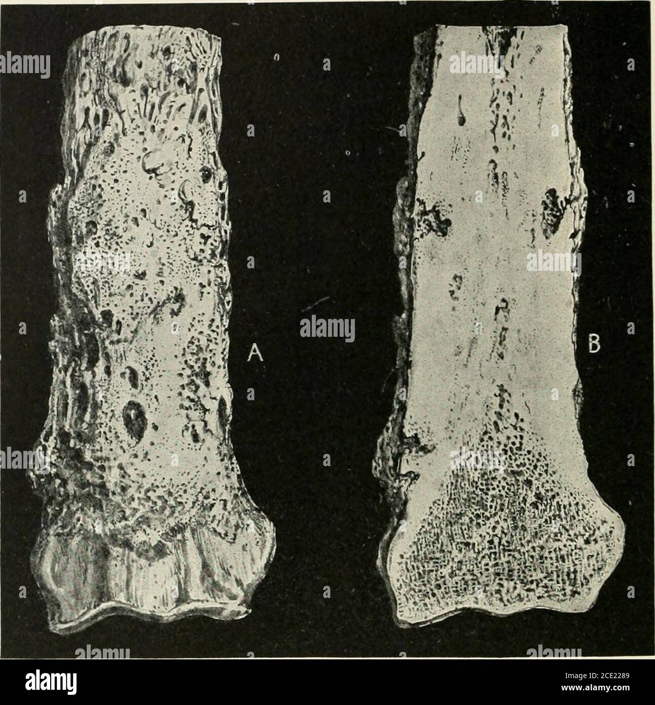 . The horse, its treatment in health and disease with a complete guide to breeding, training and management . Fig. 319.—Rarefying Chronic Ostitis This 212 HEAl.TH AND DISEASE. Fig. 320.—Chronic Ostitis A, Lower portion of Radius of horse, showing results of Chronic Ostitis. B, Section of the same,showing hard, dense condition of the bone. NECROSIS AND CARIES When bone is so far damaged by disease or accident as to cause itto die, it is said to be affected with necrosis or caries, one or the other,according to the mode of death. If a considerable quantity of the tissuebe destroyed at one time t Stock Photo