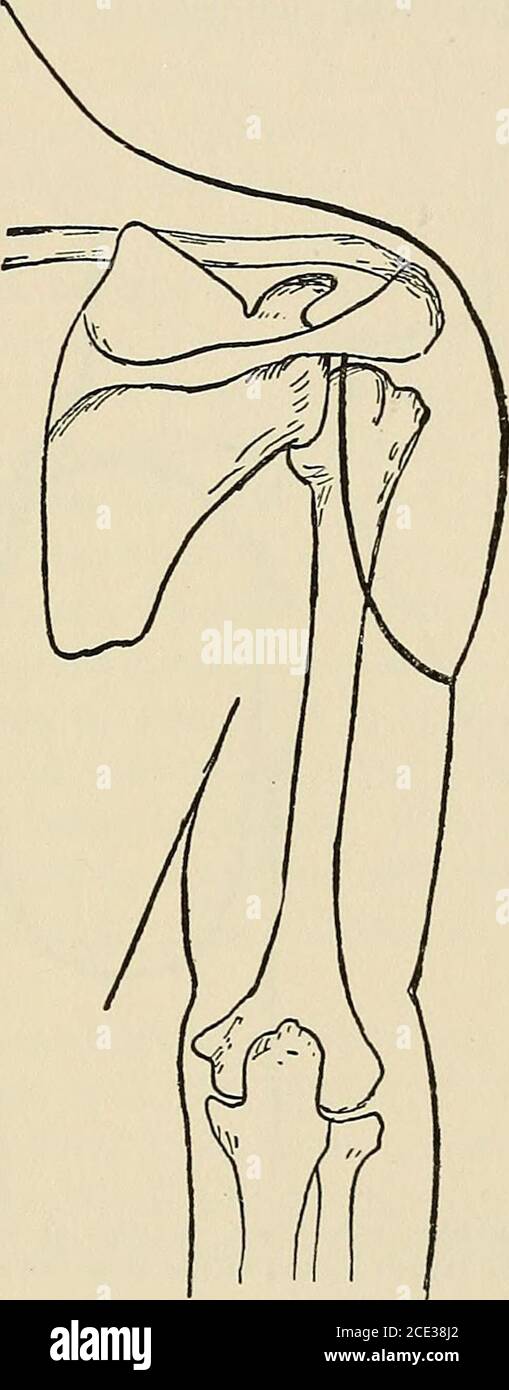 . Operative surgery, for students and practitioners . art of the ...