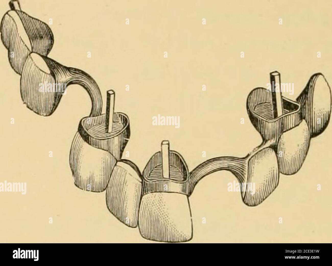 . A manual of mechanical dentistry and metallurgy . 190 MECHANICAL DENTISTRY AND METALLURGY. the