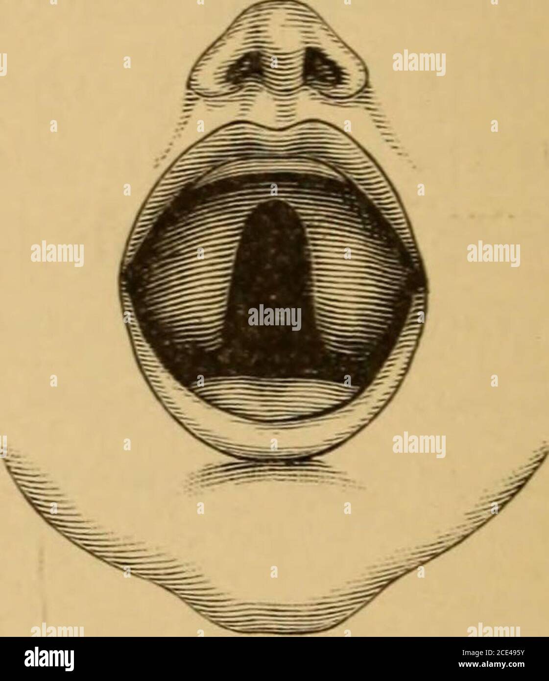 Soft palates hires stock photography and images Alamy