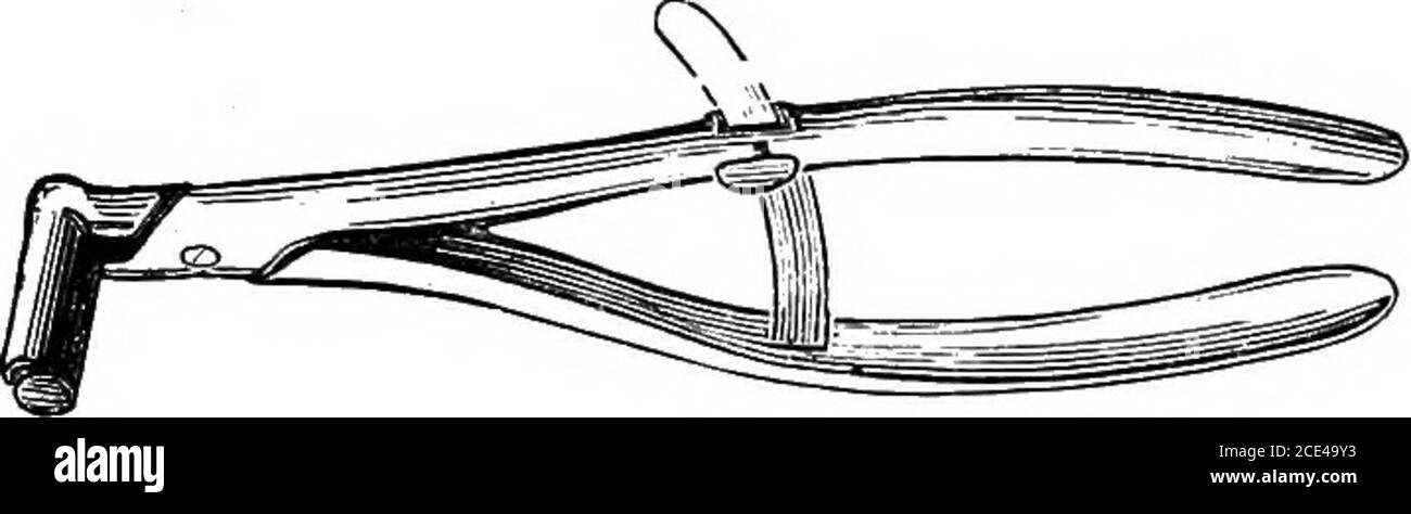 . The principles and practice of veterinary surgery . made close to the raphe, and low down towards thesheath, in order to allow the escape of all subsequent discharges,and prevent swelling. The incision is to be made with a boldsweep of the scalpel, and is to be at least three inches long, whenthe testicle will generally pop out. The smooth clam is now tobe removed, and the flat clam—serrated upon its edges^ap-plied to the spermatic cord, above the epididymus, and securely METHODS OF OPERATING. 640 fastened by pulling its handles together and fastening them withthe slide. The testicle being n Stock Photo