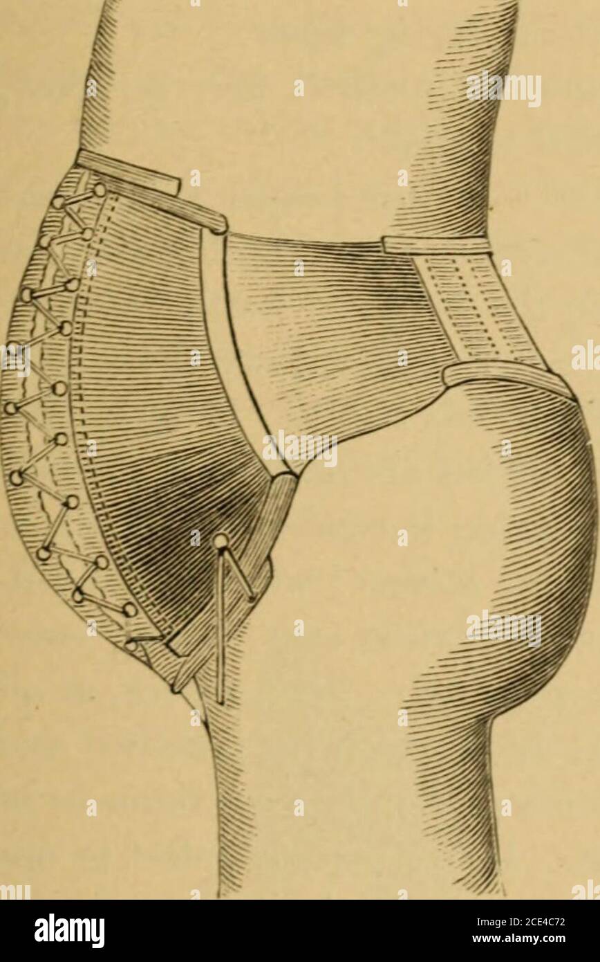 Breech Position Hi Res Stock Photography And Images Page 2 Alamy