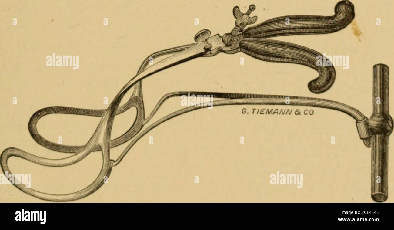 . A system of obstetrics . Huberts Axistraction Forceps. of Medicine