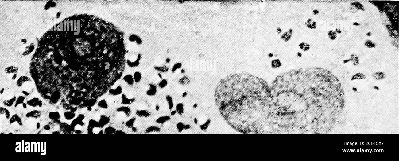 Delhi Boil Black And White Stock Photos Images Alamy