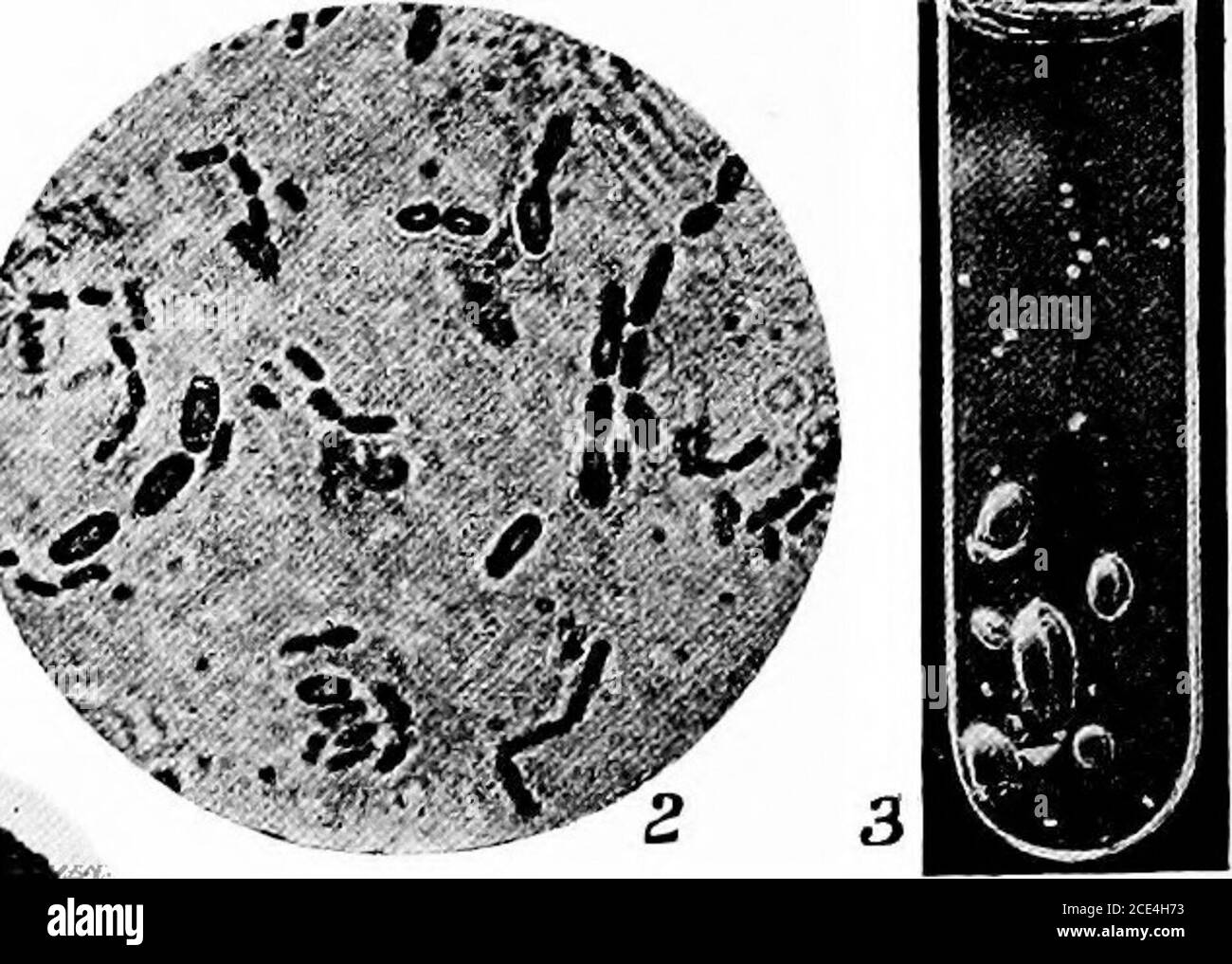 . Pathogenic microörganisms; a practical manual for students, physicians, and health officers . Fig. 157.- -Baoillus aerogenes capsulatus. 1, bacilli; S, spores; 3, culture in dextrose-nutrient agar. » Biology.—Anaerobic, non-motile, non-liquefying bacilli. They arepositive to Gram, but are more easily decolorized than many bacteria.Growth is rapid at 37° C, in the usual culture media in the absence ofoxygen, and is accompanied by the production of gas. Nutrient gelatinis not liquefied, but it is gradually peptonized. On agar colonies aredeveloped which are from 1 to 2 mm. or more in diameter Stock Photo
