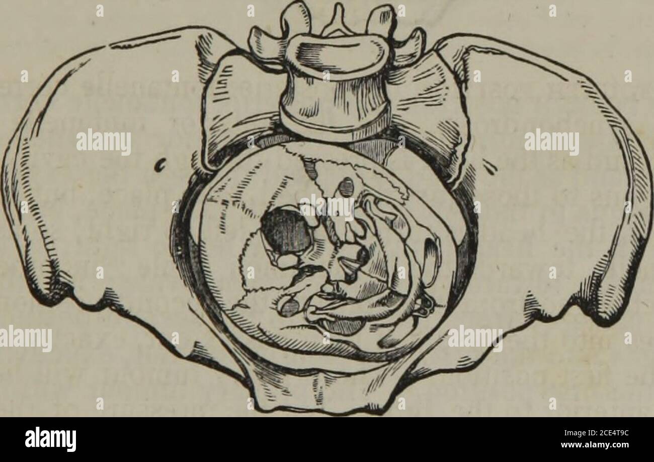 Sagittal suture hi-res stock photography and images - Alamy
