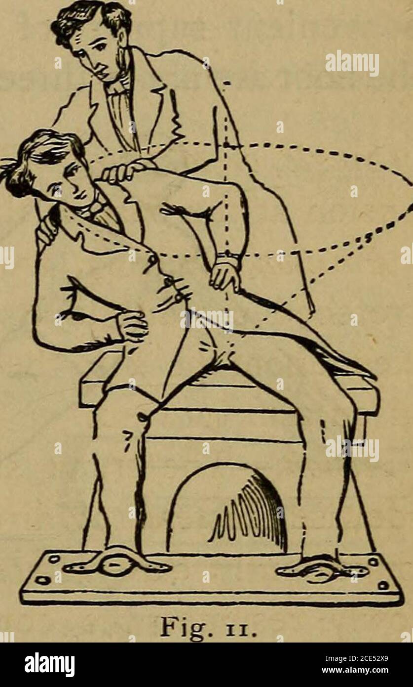 . Pelvic and hernial therapeutics : principles and methods for remedying chronic affections of the lower part of the trunk, including processes for self-cure . ad circle, while the^seat remains unmoved. This rotarymotion rhay be performed six or eighttimes in each direction. If thestrength be insufficient for the proc-ess, the hands may be fixed on thehips instead of the head, when lessstrength will be required. Effects.—This mode of acting onthe muscles and their tendinous ex-tensions, affords only a momentary strain and incitation toany single part, but all parts at the base of the body areb Stock Photo