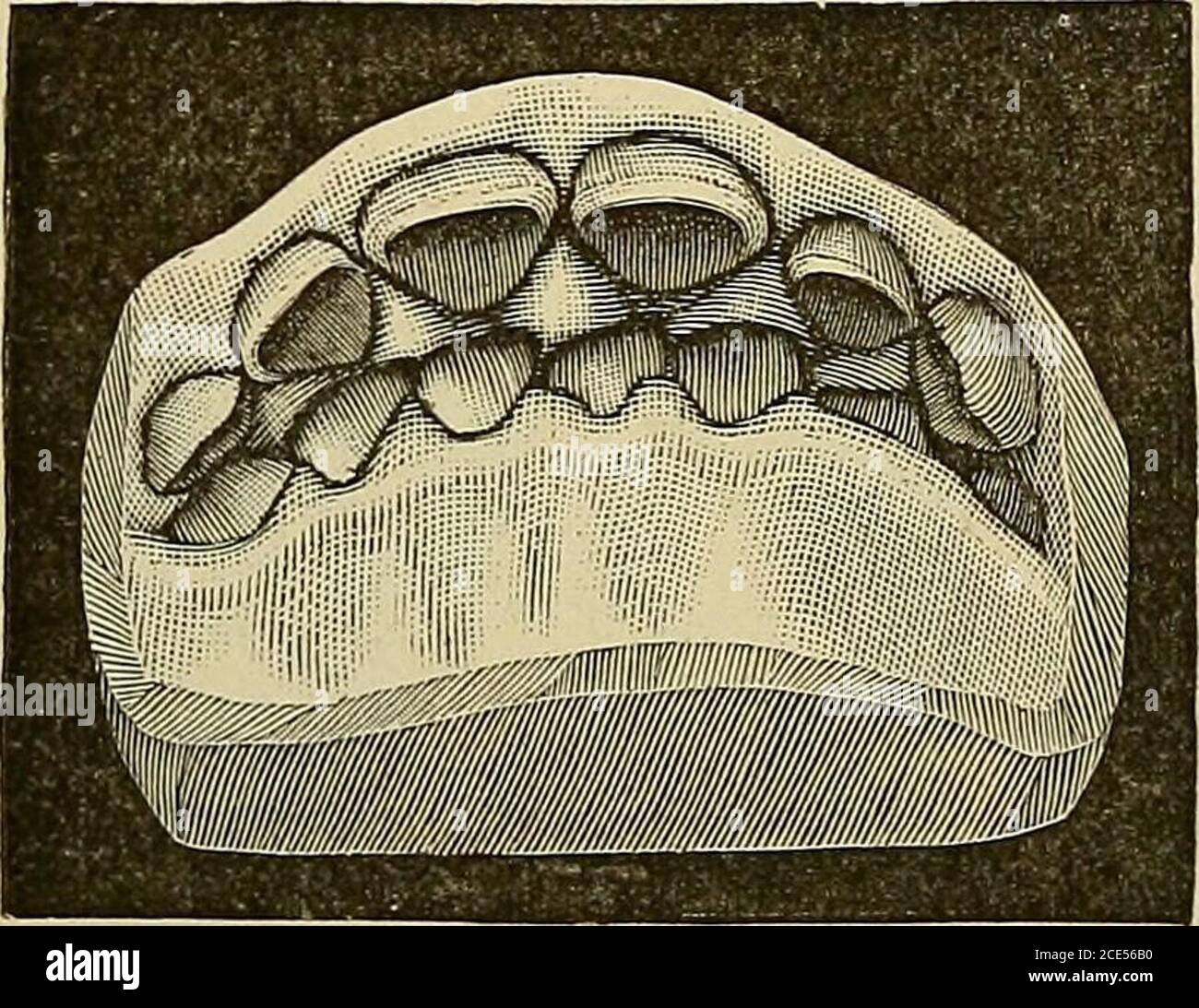 . Orthodontia, or malposition of the human teeth; its prevention and ...