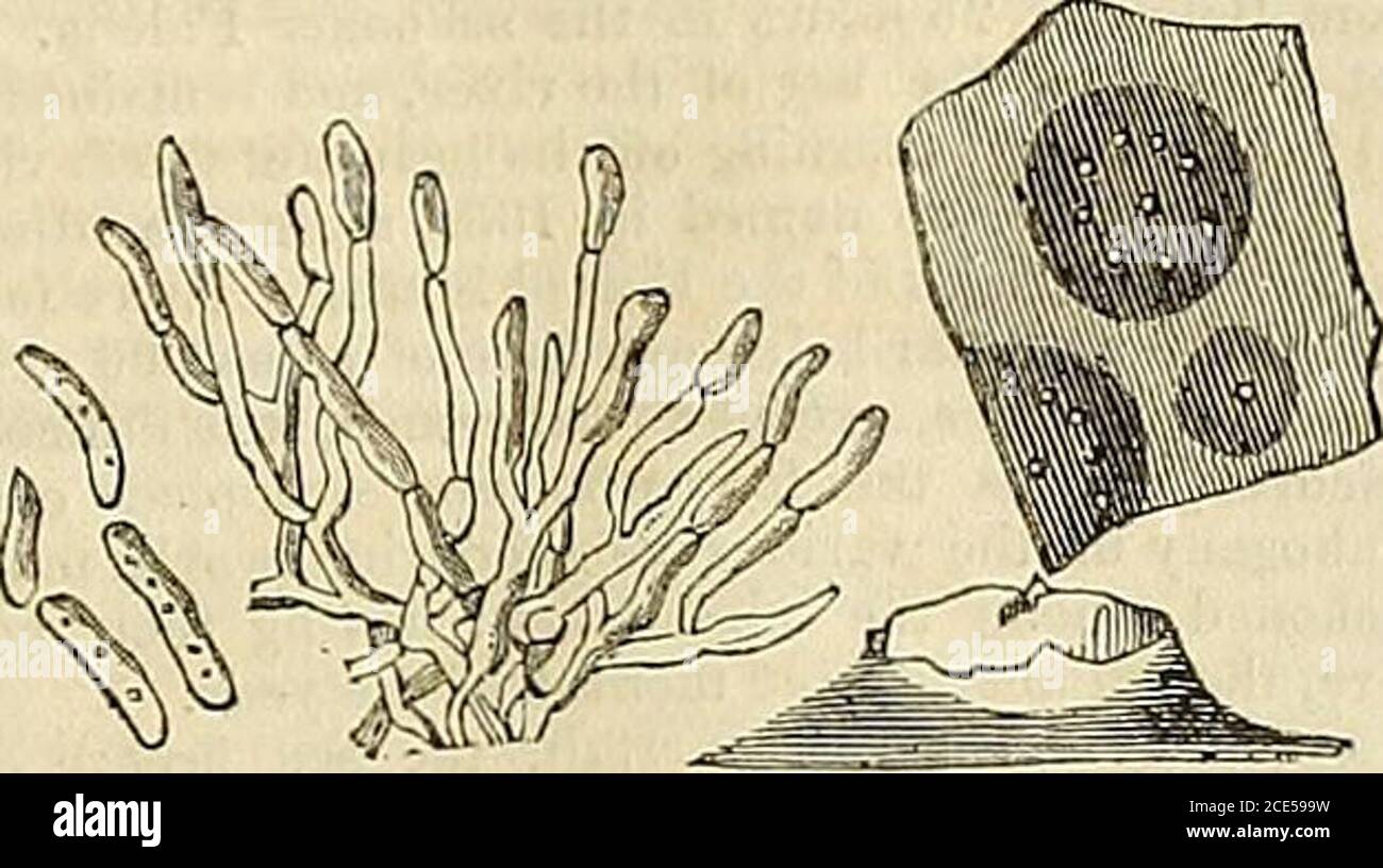 . The Gardeners' Chronicle and Agricultural Gazette . in the Gardeners^ Chronicle, 1854, p. 676, andthe subjoined figure compared with the one there givenwould at first seem to indicate an identity. But thespores were more inclined to be curved, rather longer,and not so variable in size, and the want of a peri-theclum separated the two widely from each other.The Grape fungus, according to received principles,was a Septoria, while this is a Glseosporium, At thesame time these organisms are so different in differentconditions, that I would not affirm that the two produc-tions are essentially dif Stock Photo