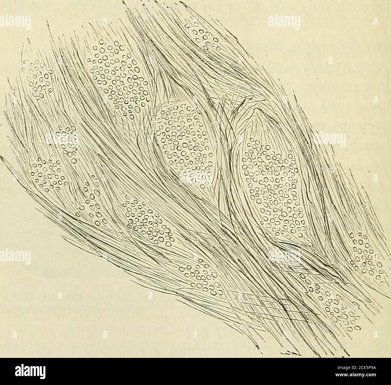Fibrous tissue in the uterus hi-res stock photography and images - Alamy