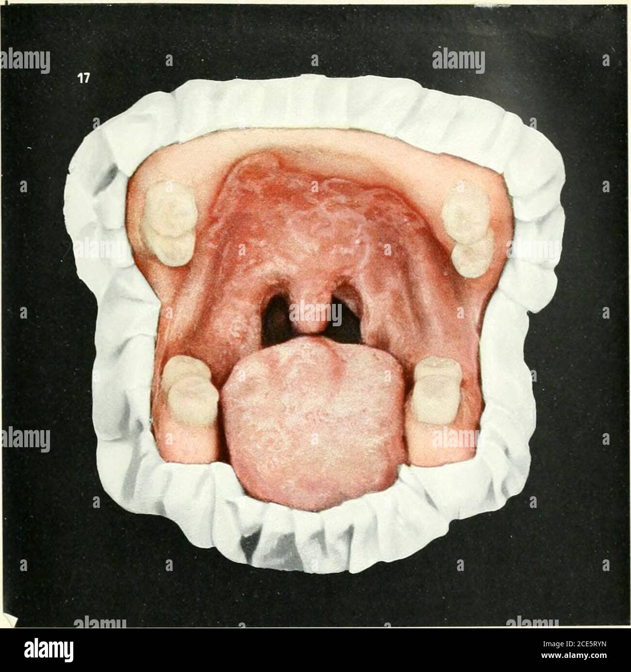 . Diseases of the mouth; for physicians, dentists, medical and dental