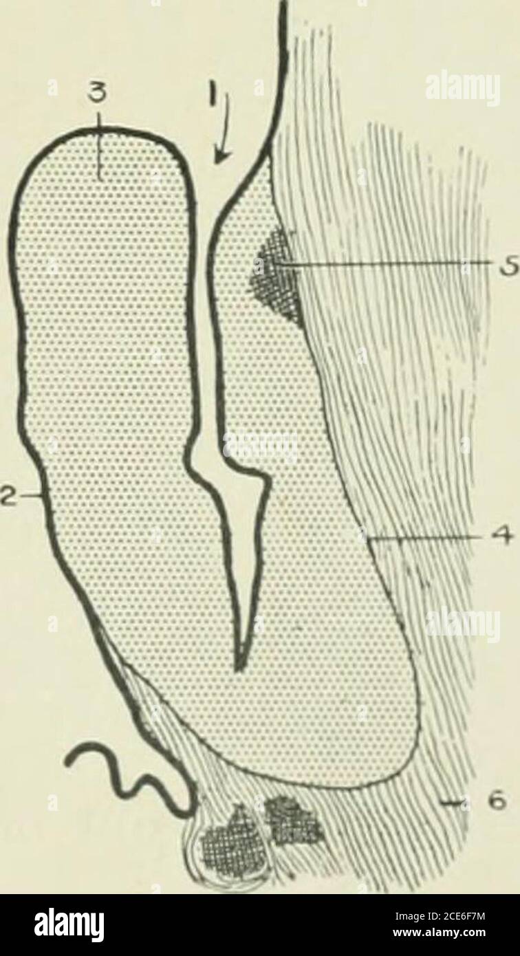 Journal Of Anatomy Fig It3r Fig 17 A Fig 18a 48 Mr G Seccombe Hett And Mr H G Butterfield Tonsil Of The Lynxes But The Fossa Has Become Very