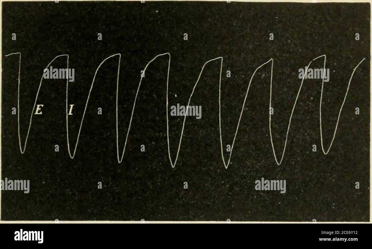 Abdomena hires stock photography and images Alamy