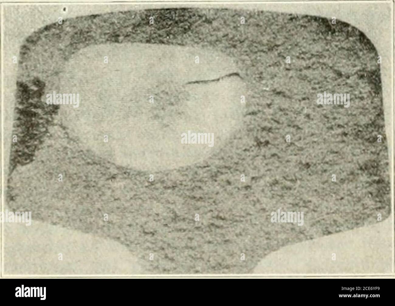 Engineering and Contracting . Transverse Fissure Partly