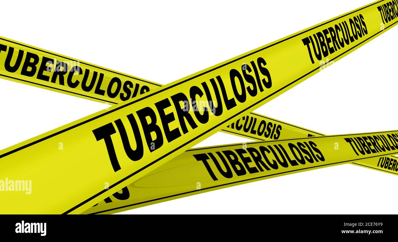 Yellow warning tapes with black words TUBERCULOSIS (is an infectious disease usually caused by Mycobacterium tuberculosis bacteria). Isolated Stock Photo