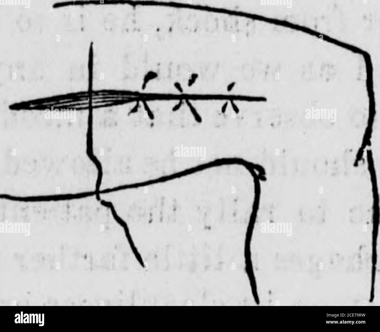 Sew a bandage Black and White Stock Photos & Images - Alamy
