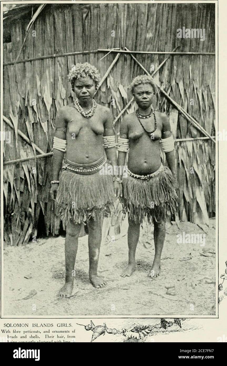 . Women of all nations, a record of their characteristics, habits, manners, customs and influence; . costumes does notentail the casting off of the old, and thetwo Fijian girls on p. 97 wear the nativeand the imported garments in somewhatincongruous juxtaposition. Bark-cloth is made and worn in someof the islands, although it does not playsuch an important part in Melanesia asin Polynesia, nor is it so artisticallytreated. It only comes into common use In the Solomon Islands the bark of thepaper mulberry (Broussonctia papyrifcra)is stripped off, steeped in water,hammered to the required size a Stock Photo