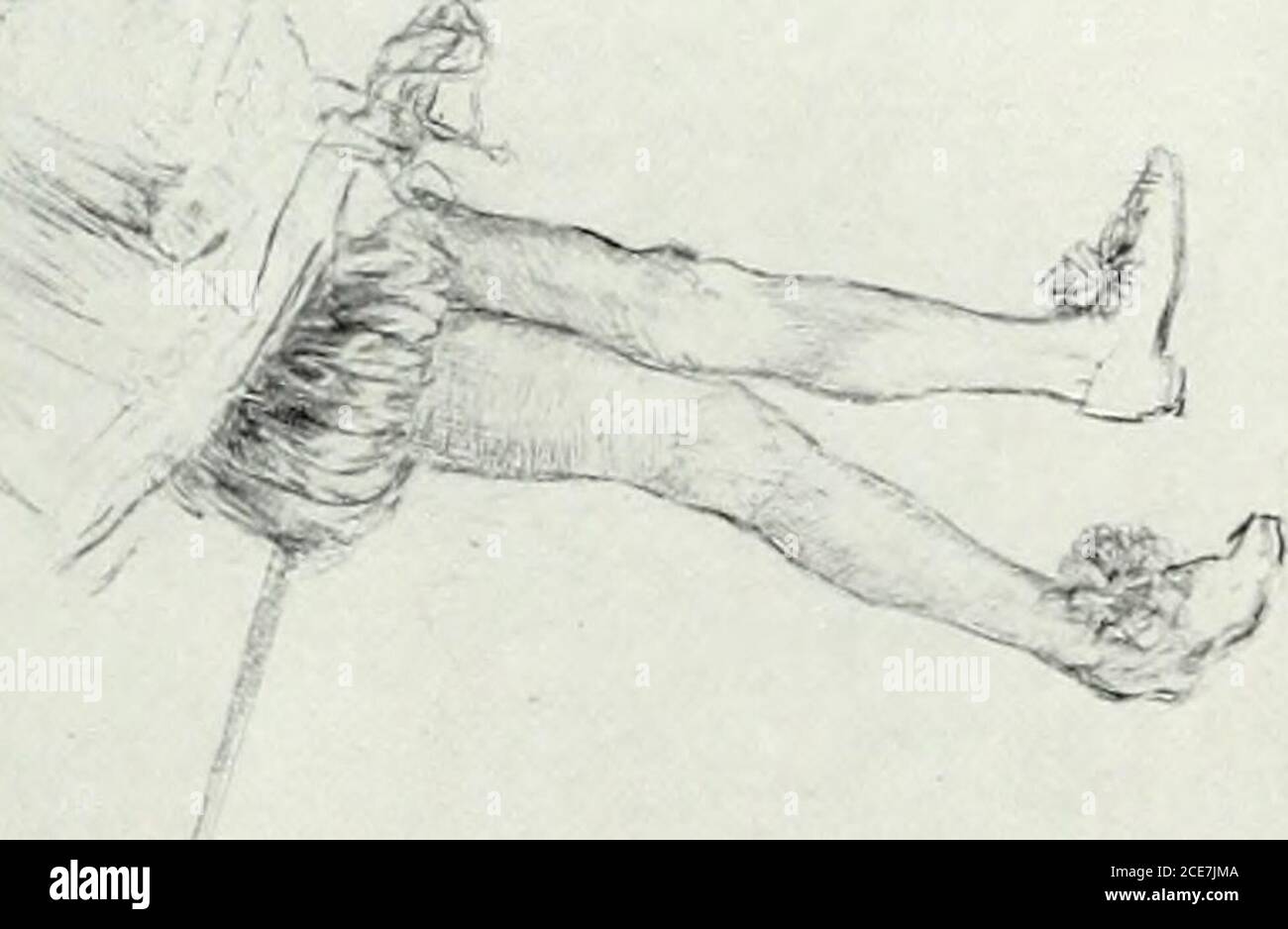 Featured image of post View 11 Lying Down Dead Body Drawing Reference