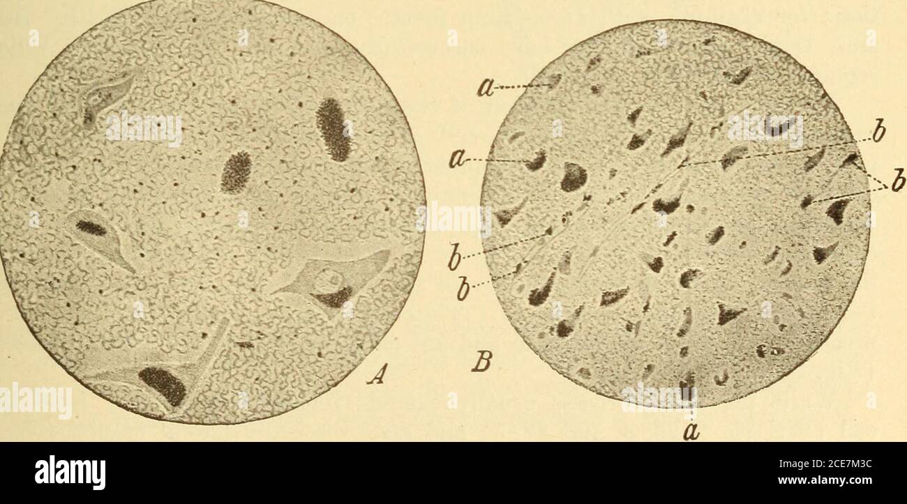 . Diseases of the nervous system . osed of a fine fibrillary net ...