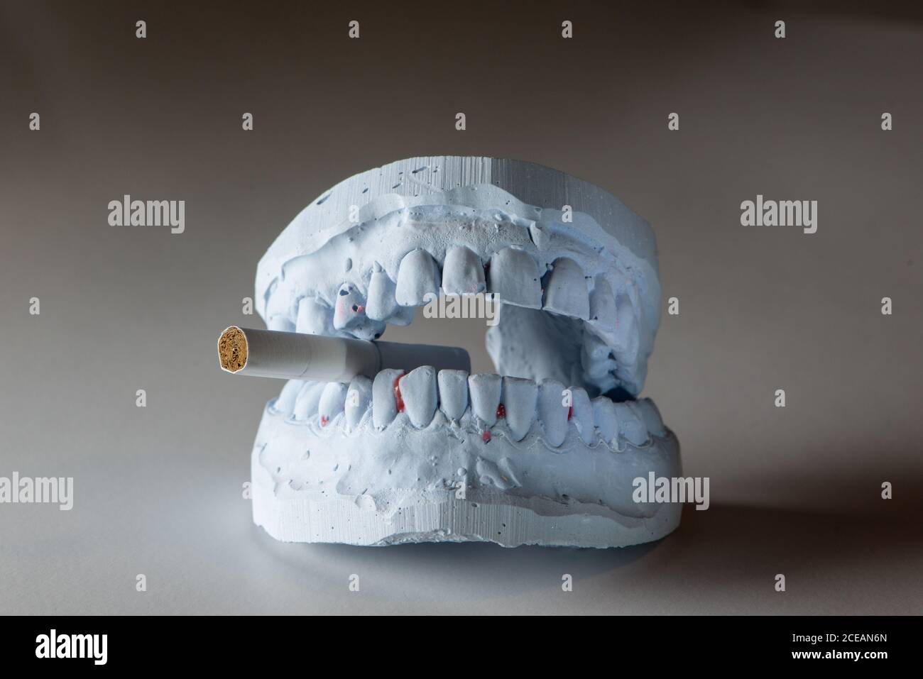 Smoking cause health damage and death. Stop smoking concept. Dental gypsum model with cigarette. Stock Photo