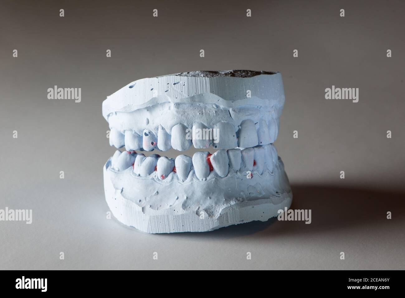 Dental gypsum model, isolated Stock Photo