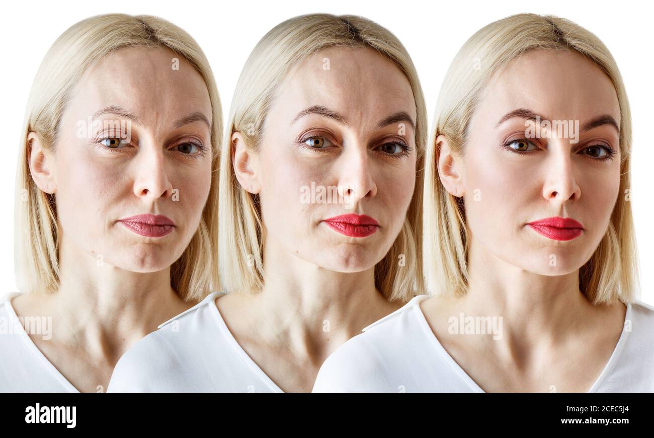 Three close-up portraits of a woman, comparison before and after Stock Photo