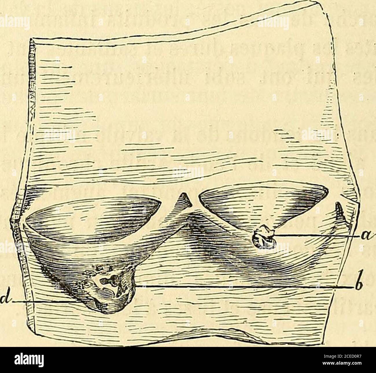 protection latérale pour lunettes de vue