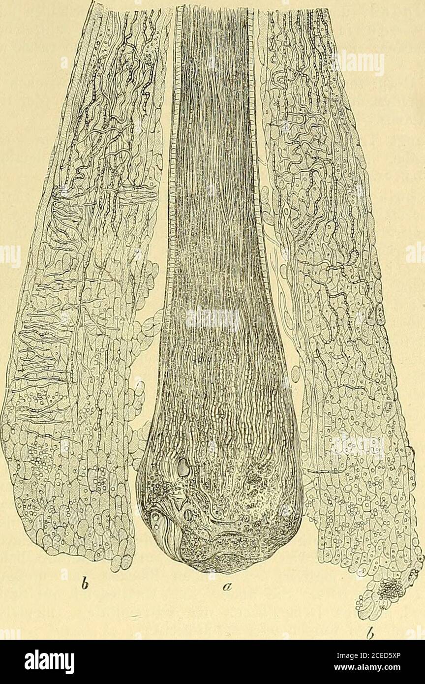 Lehrbuch der allgemeinen und speciellen pathologischen Anatomie und  Pathogenese. , so rücken dieselben zu grösserenMassen zusammen. Wird die  Epidermisdecke abgestossen, so tritt dieFavusmasse frei zu Tage und  trocknet zu gelbweissen, mörtelartigenMassen