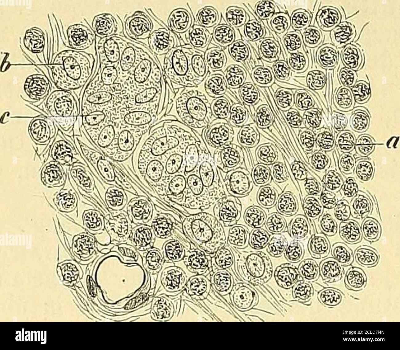 Condyloma hi-res stock photography and images - Alamy