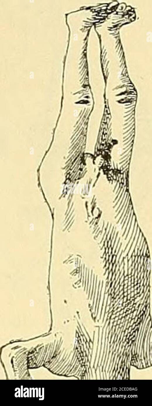 . Lehrbuch der allgemeinen und speciellen pathologischen Anatomie und