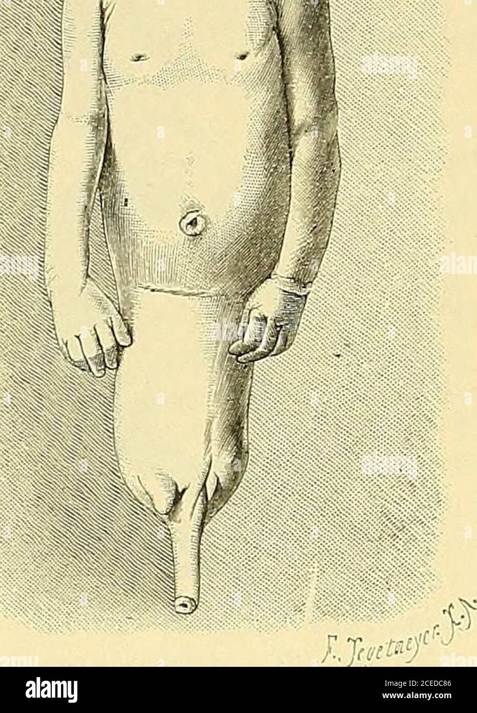 Er ist ihrem Anus verfallen Er ist ihrem Anus verfallen