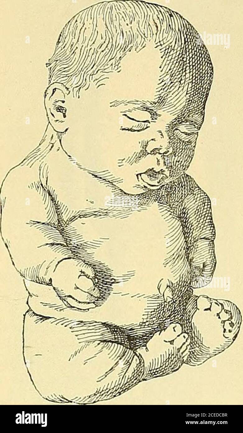 . Lehrbuch der allgemeinen und speciellen pathologischen Anatomie und
